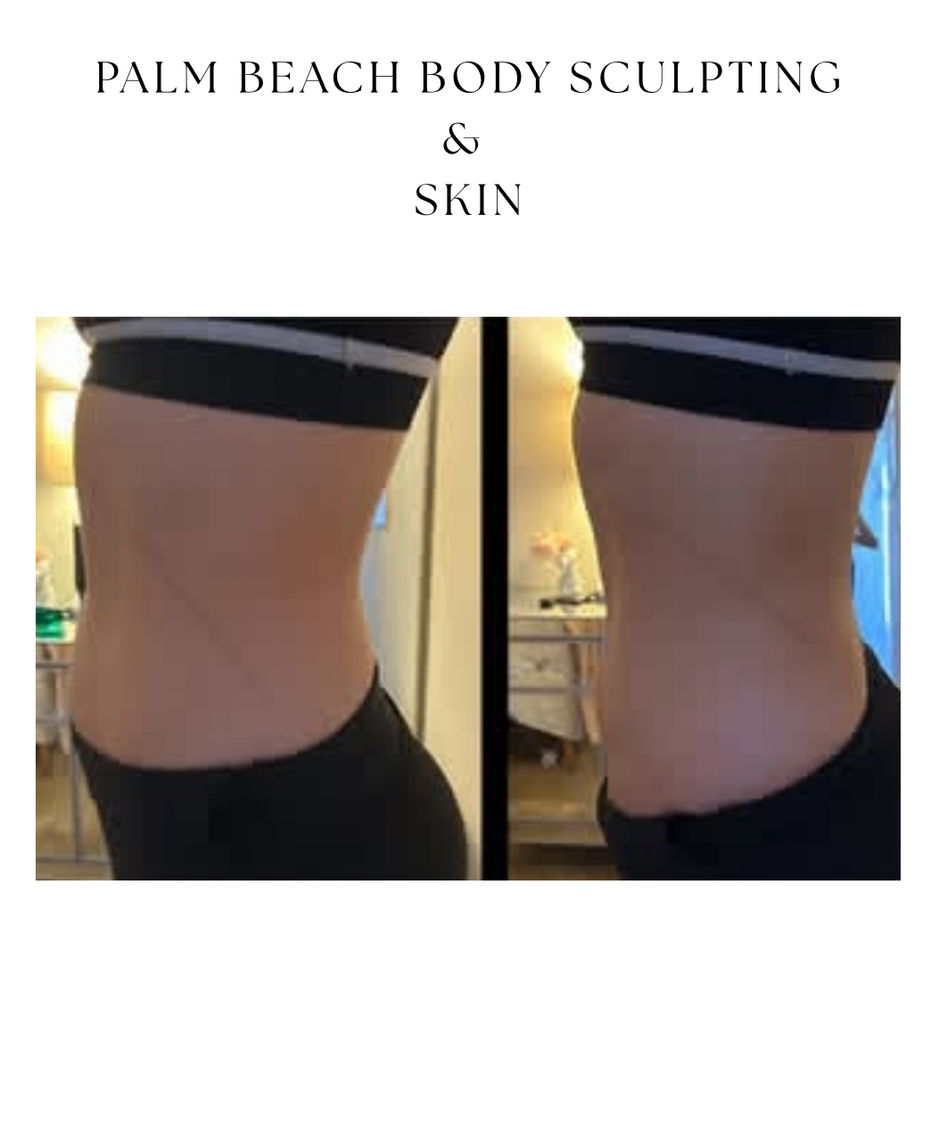 Brazilian Sculpt & Glow | Jupiter & West Palm Beach, FL