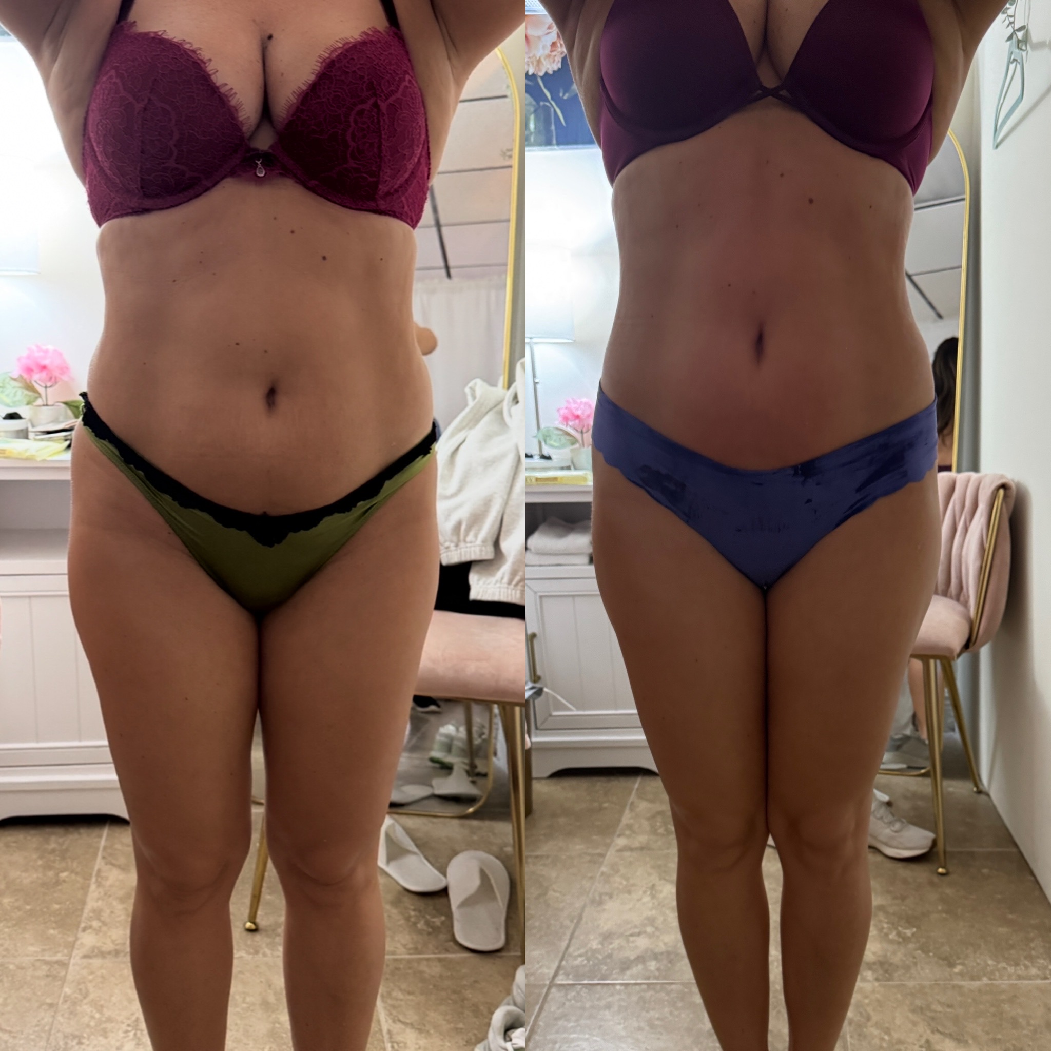 EMS before and after – female full body toning