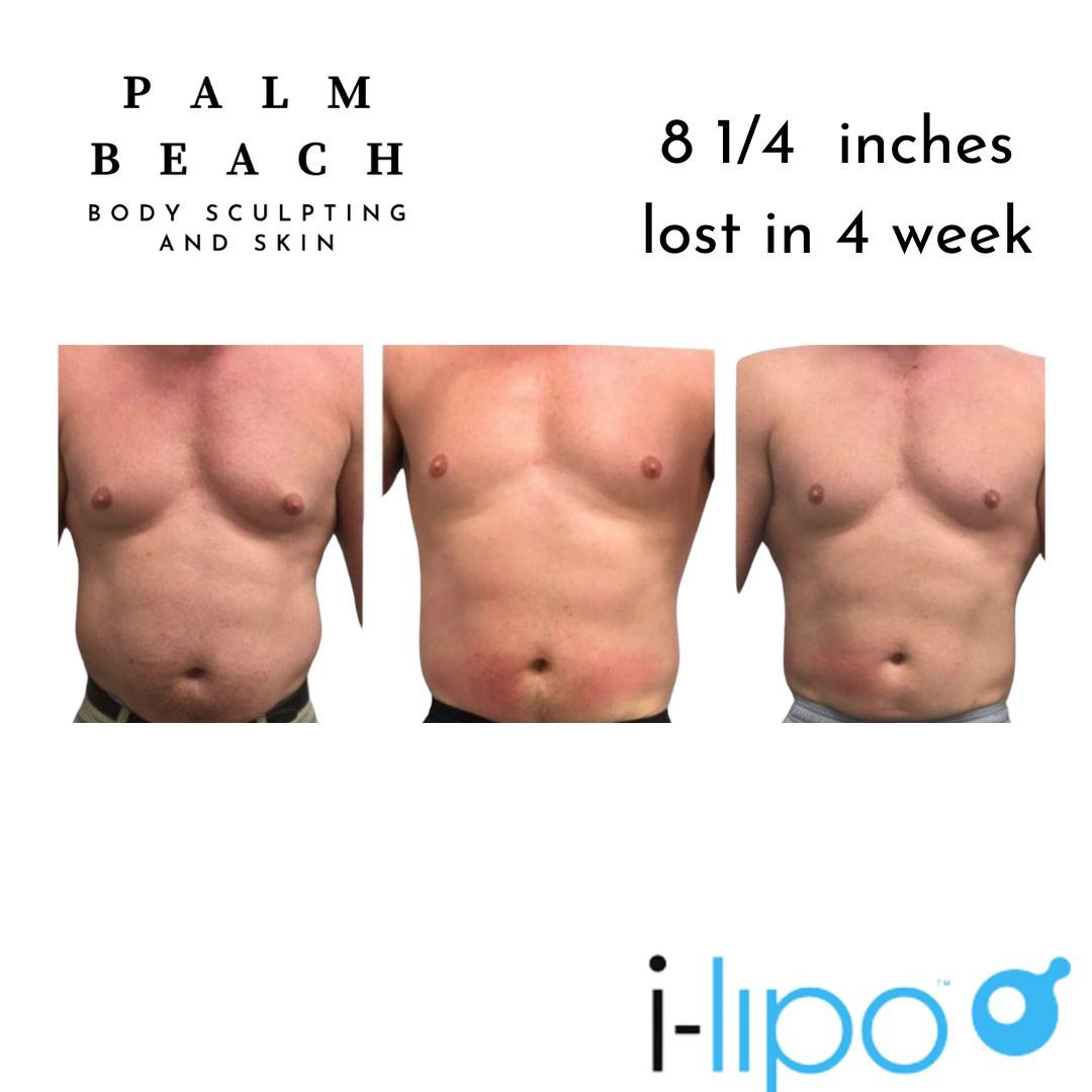 Before and after result 1