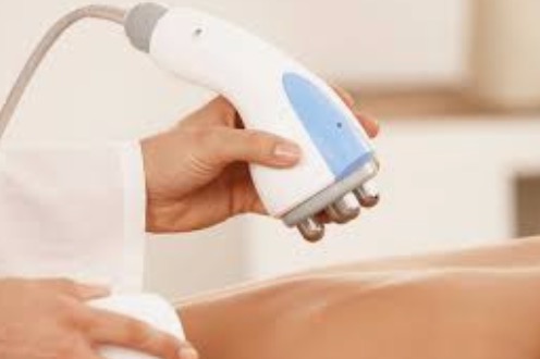 RF radiofrequency skin tightening treatment — Palm Beach Body Sculpting & Skin