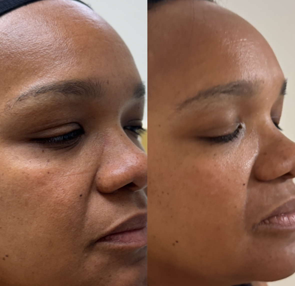 Facial Treatment